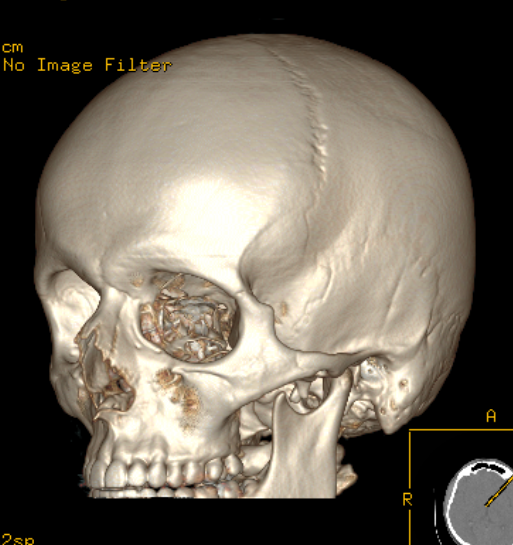 12.03.2023_14.33.40_REC