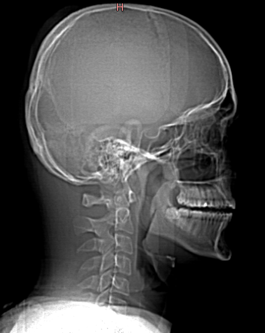 10.03.2023_19.18.21_REC